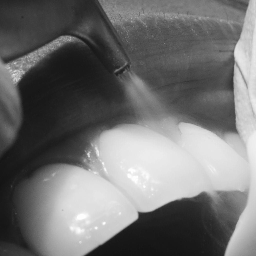periodontist london