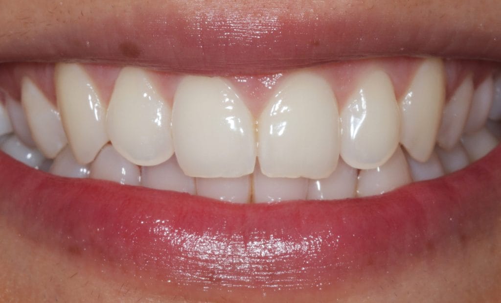 healthy gums