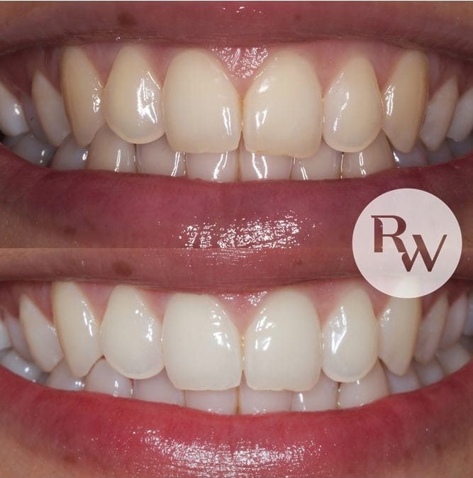 teeth maintenance, periodontist london