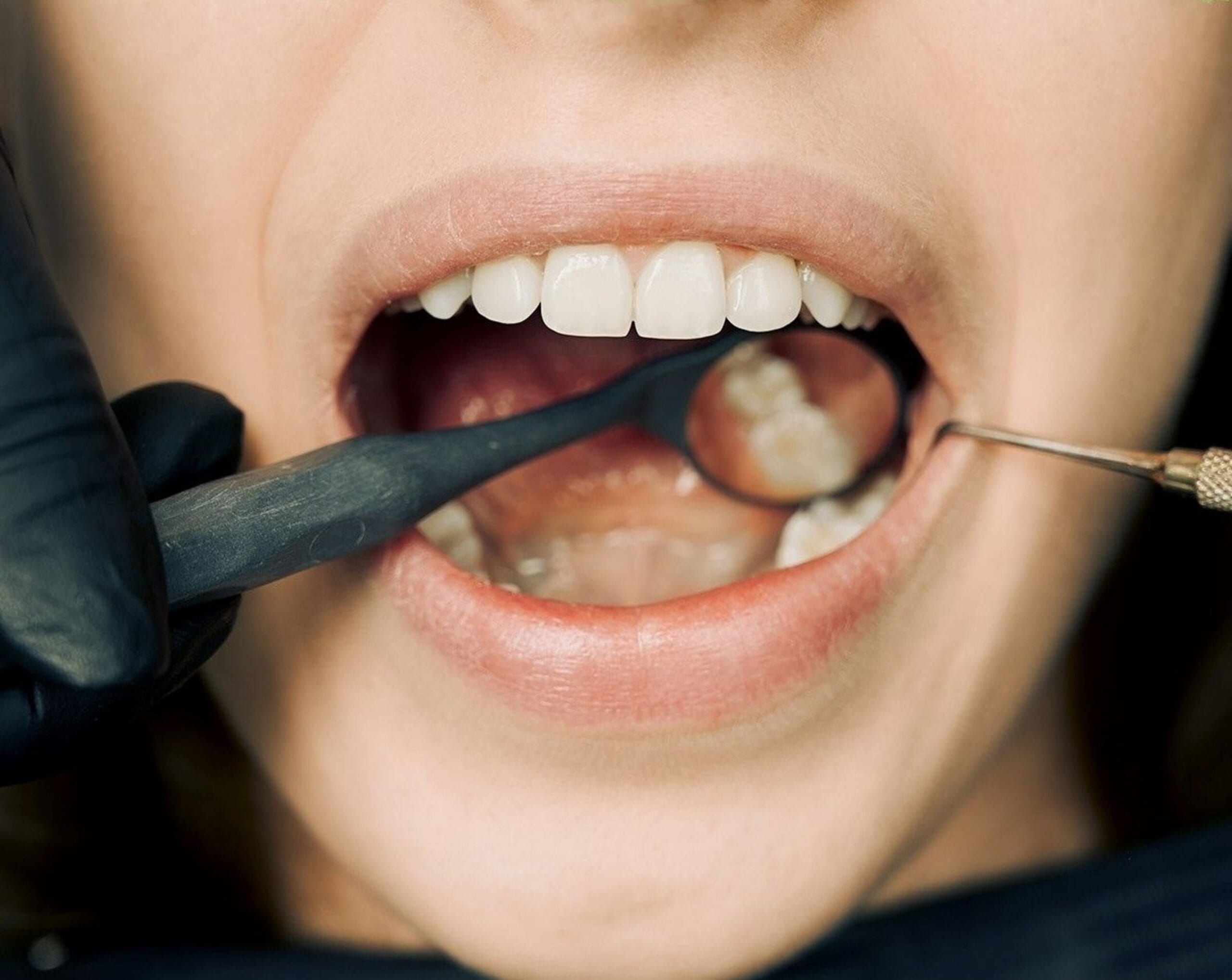 periodontal treatment|periodontal disease|periodontal disease|gum disease treatment|periodontal disease|periodontal disease