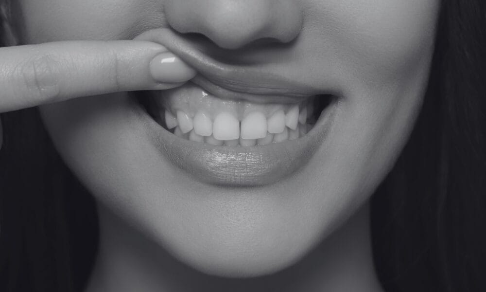 Healthy gum and a healthy smile at RW Perio